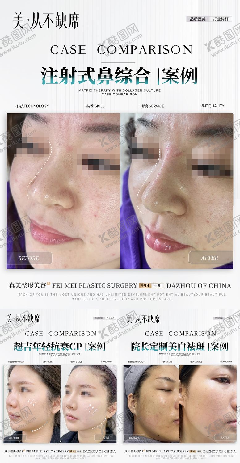 编号：97252407171748255309【酷图网】源文件下载-美业案例对比