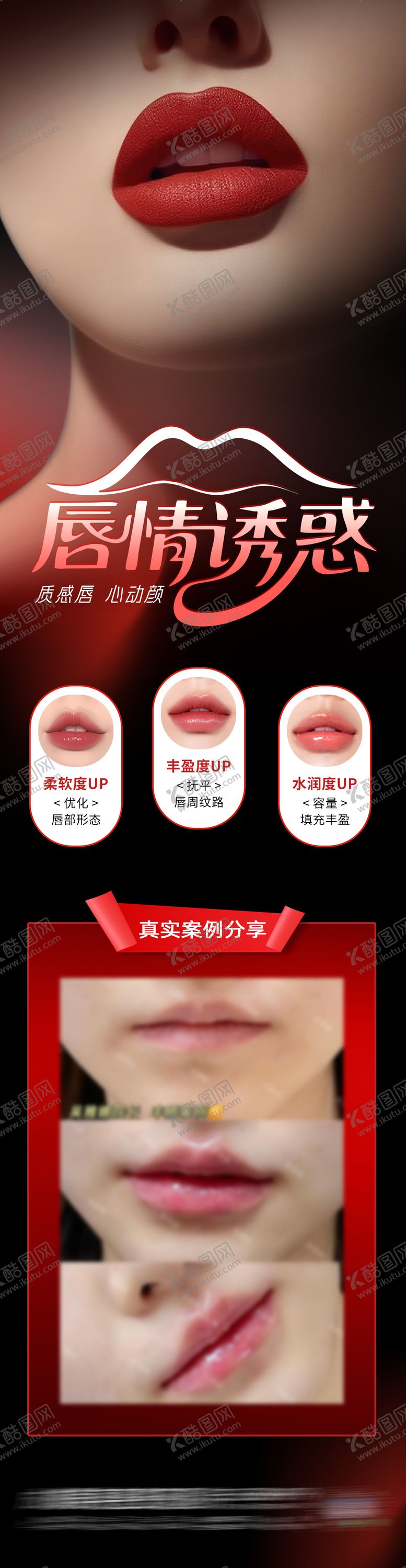 编号：45378609280506128205【酷图网】源文件下载-医美玻尿酸唇部塑形案例红黑创意海报
