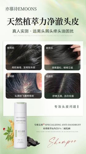 洗发乳头皮去屑对比海报