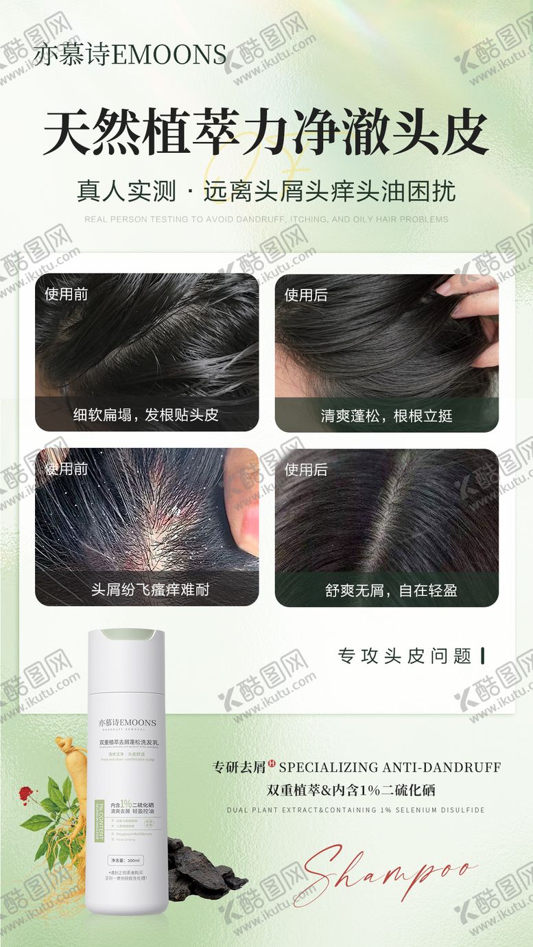 编号：28975508191649353387【酷图网】源文件下载-洗发乳头皮去屑对比海报