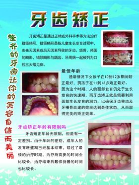 需要矫正的牙齿