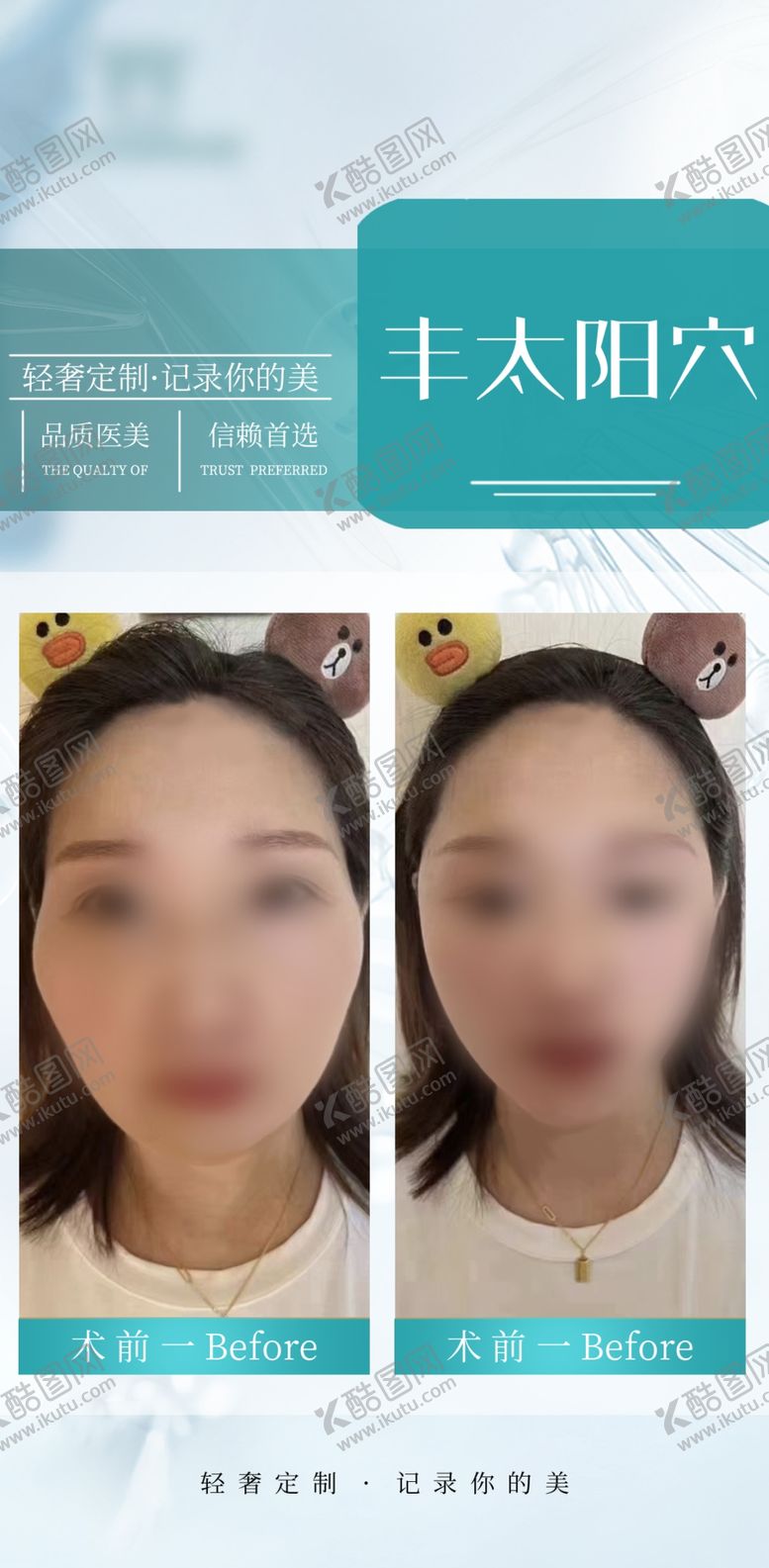 编号：90587401250759212044【酷图网】源文件下载-丰太阳穴案例