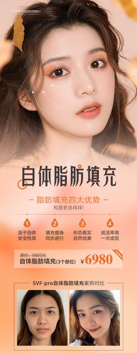 医美脂肪填充专题