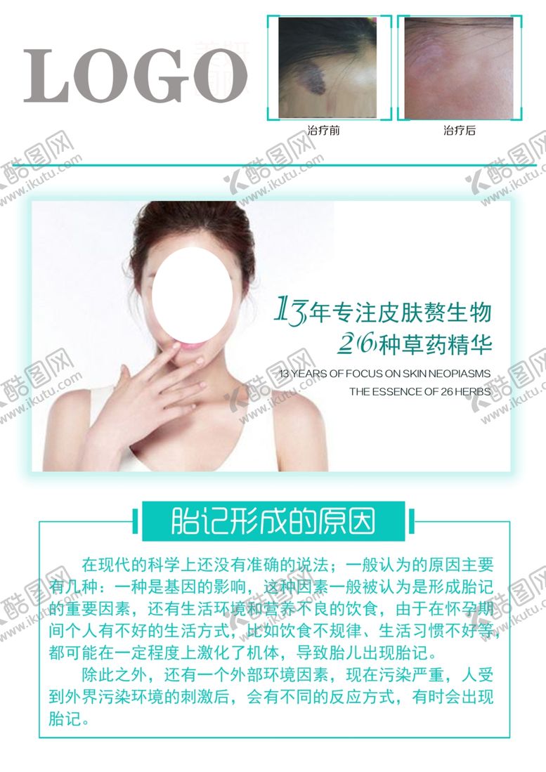 编号：54310010250018192101【酷图网】源文件下载-胎记