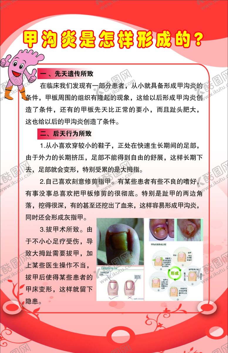 编号：14203310310156468797【酷图网】源文件下载-甲沟炎是怎样形成的