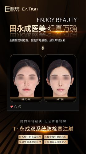 医美黑金高级案例海报