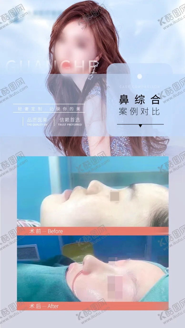 编号：37987612041621368401【酷图网】源文件下载-鼻综合案例