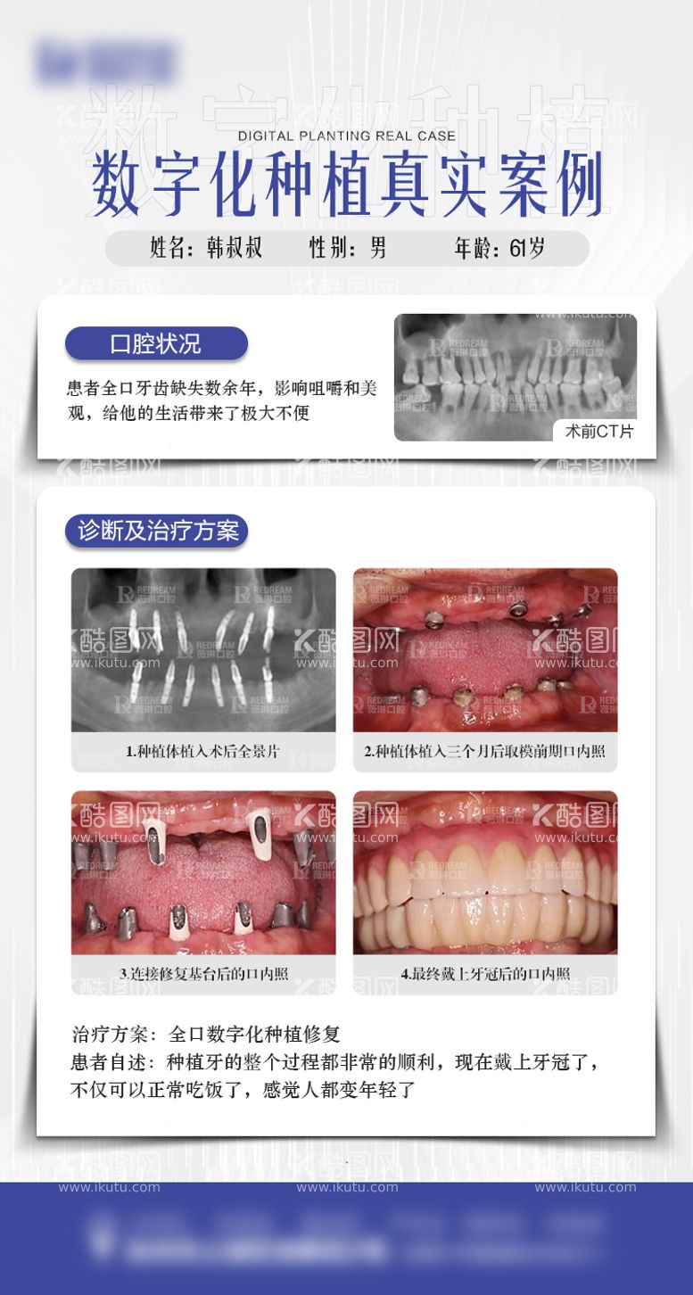 编号：42831011301751145668【酷图网】源文件下载-口腔种植牙海报