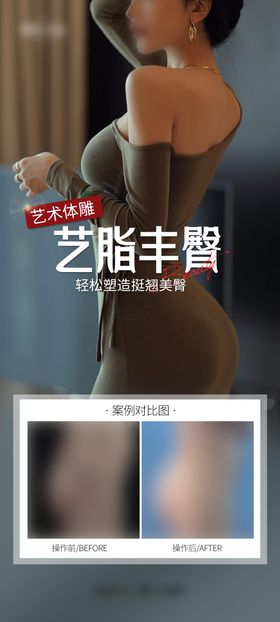 医美丰臀海报