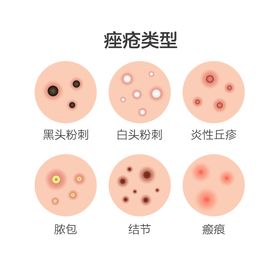 新闻资讯类型网站