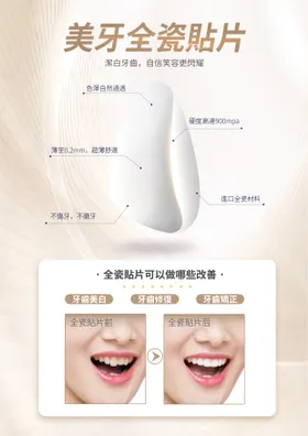 美牙全瓷贴片海报