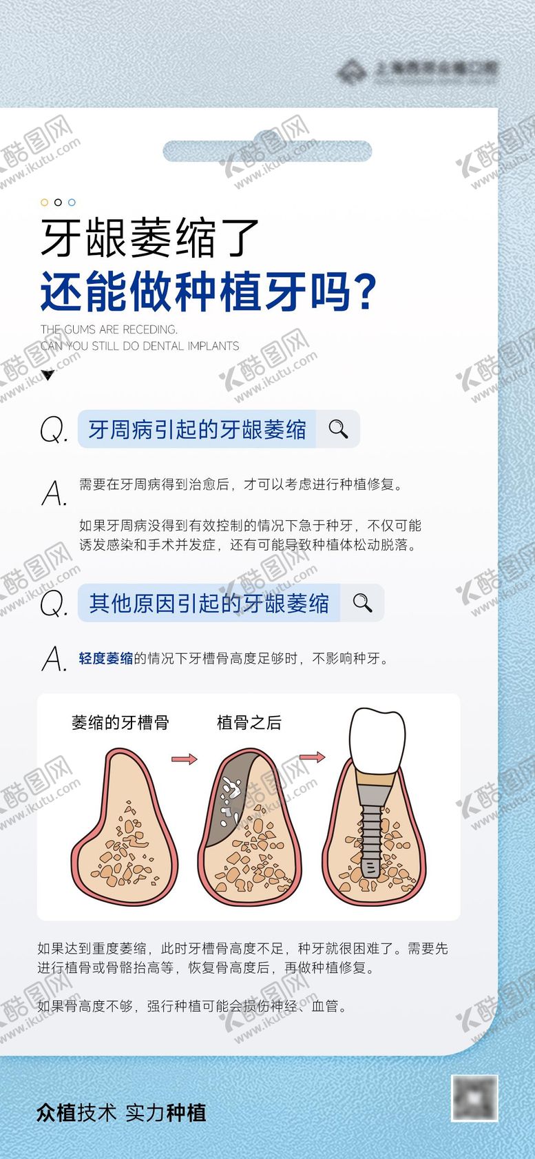 编号：96232512040733092790【酷图网】源文件下载-牙龈萎缩种植牙科普海报