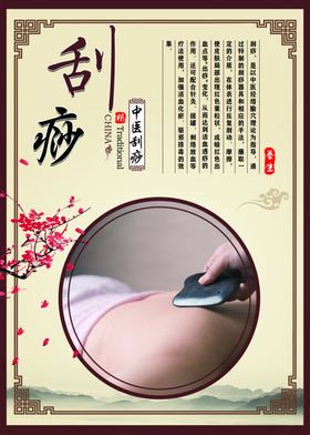 刮痧