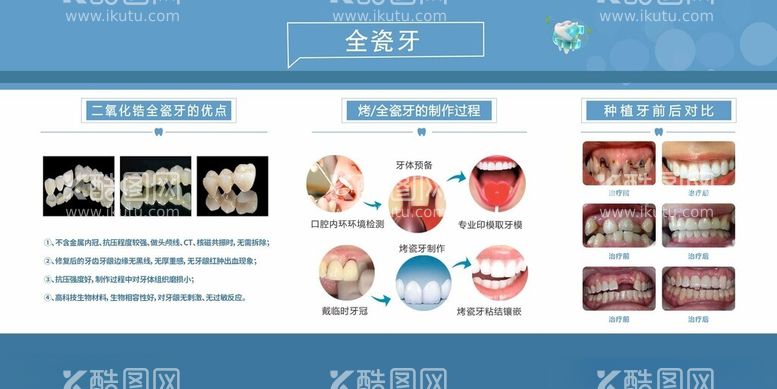 编号：84361112172215116227【酷图网】源文件下载-全瓷牙