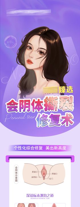 会阴撕裂修复术海报