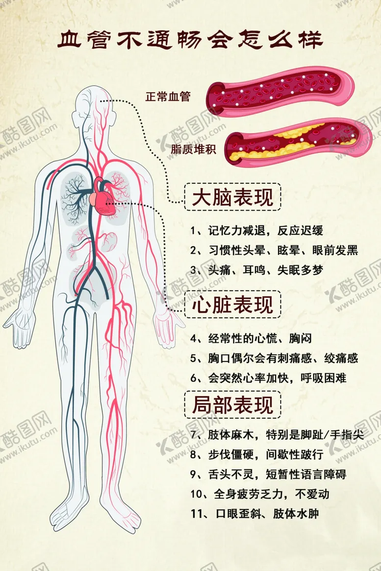 编号：96934502060444279399【酷图网】源文件下载-血管不通畅