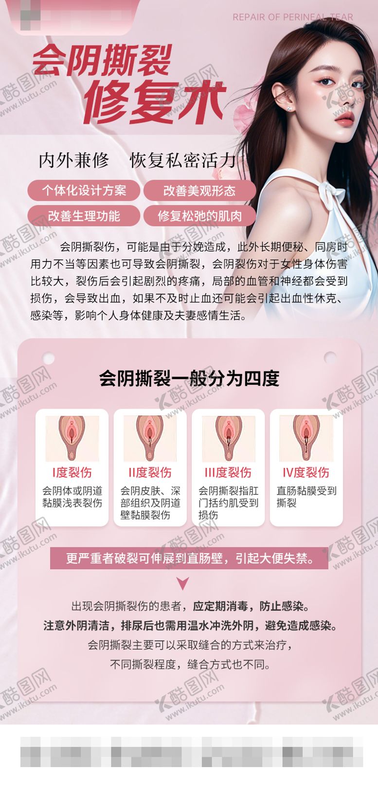 编号：67510810231402417961【酷图网】源文件下载-会阴撕裂修复术海报