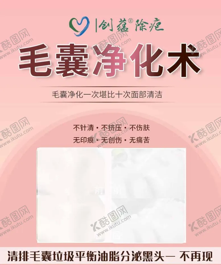 编号：38402909162159116238【酷图网】源文件下载-创蕴除疤