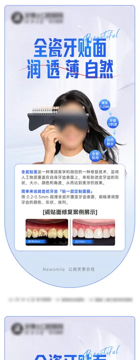 口腔瓷贴面美白海报
