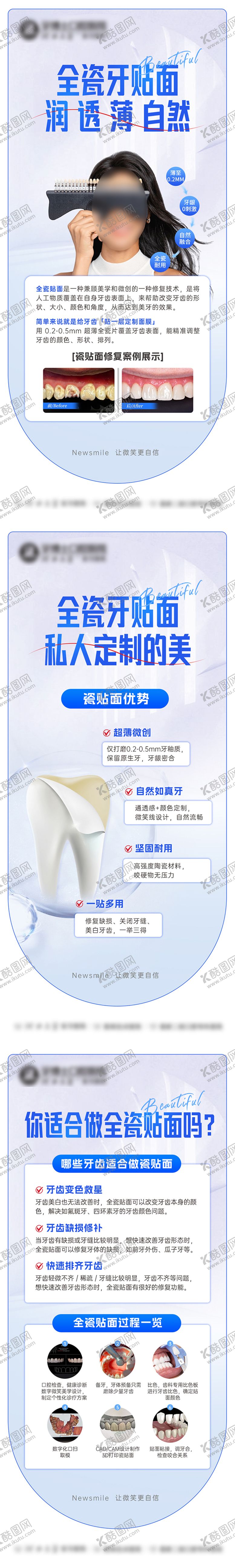 编号：87287909132108198232【酷图网】源文件下载-口腔瓷贴面美白海报