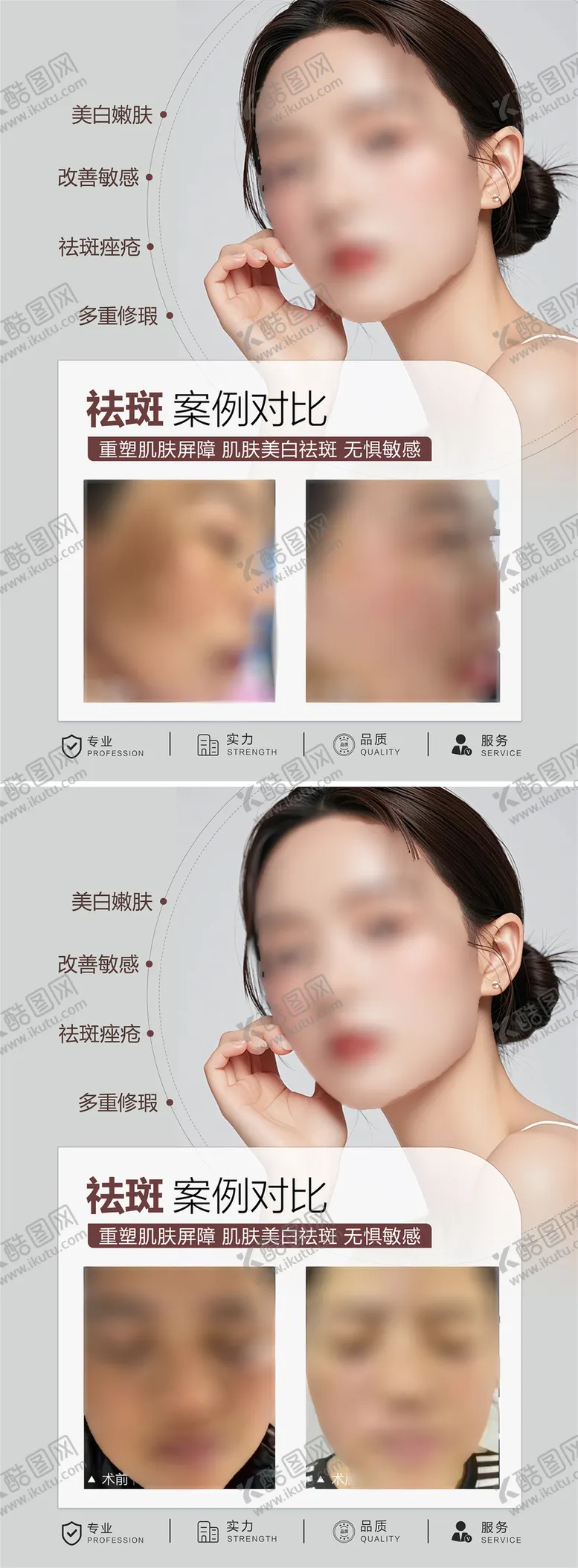 编号：46480104190624088747【酷图网】源文件下载-医美祛斑案例海报