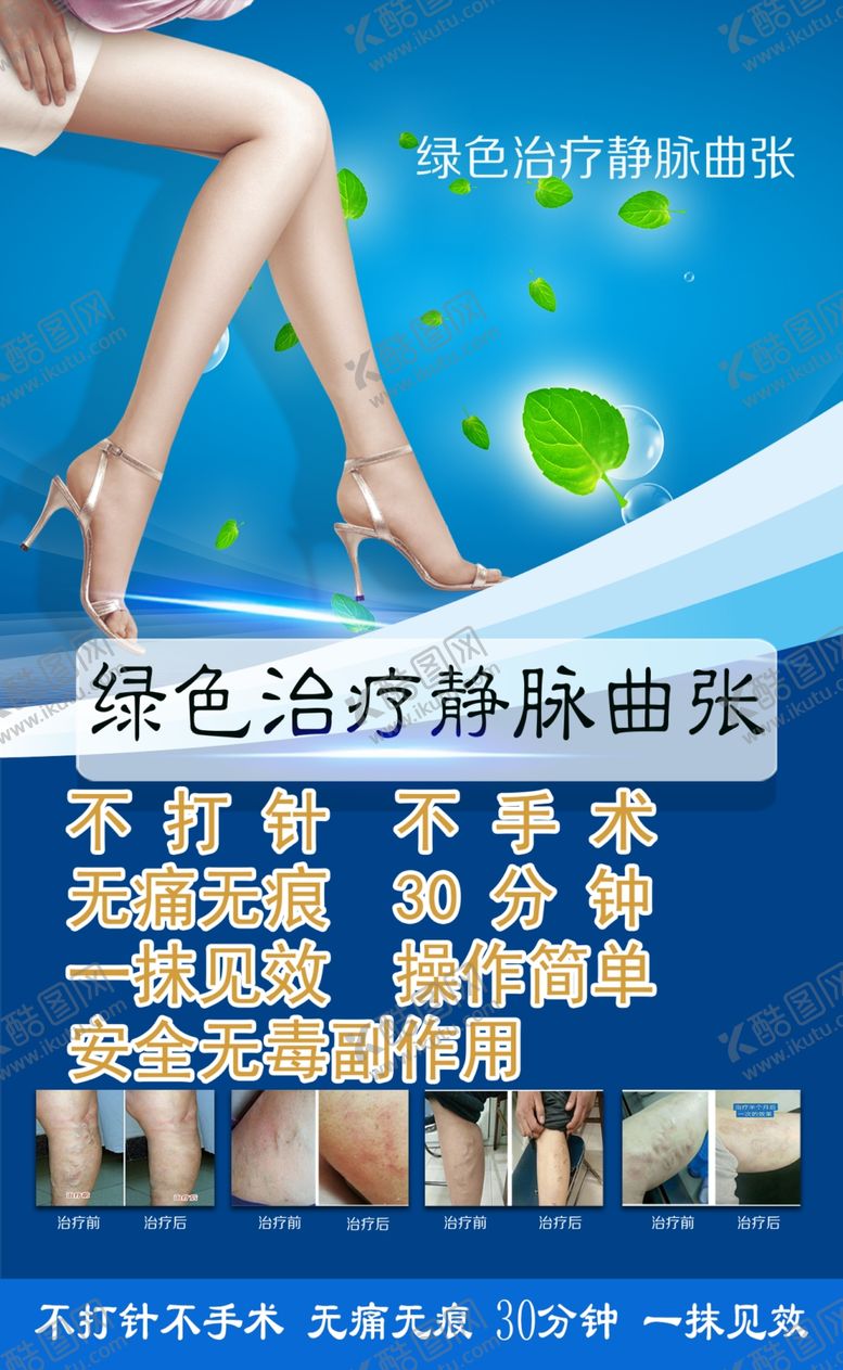 编号：34882010292132341744【酷图网】源文件下载-静脉曲张