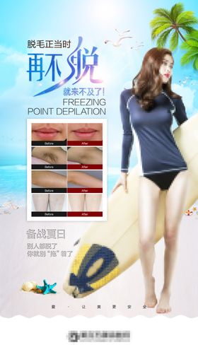 脱毛