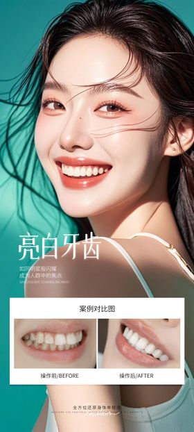 牙齿美白