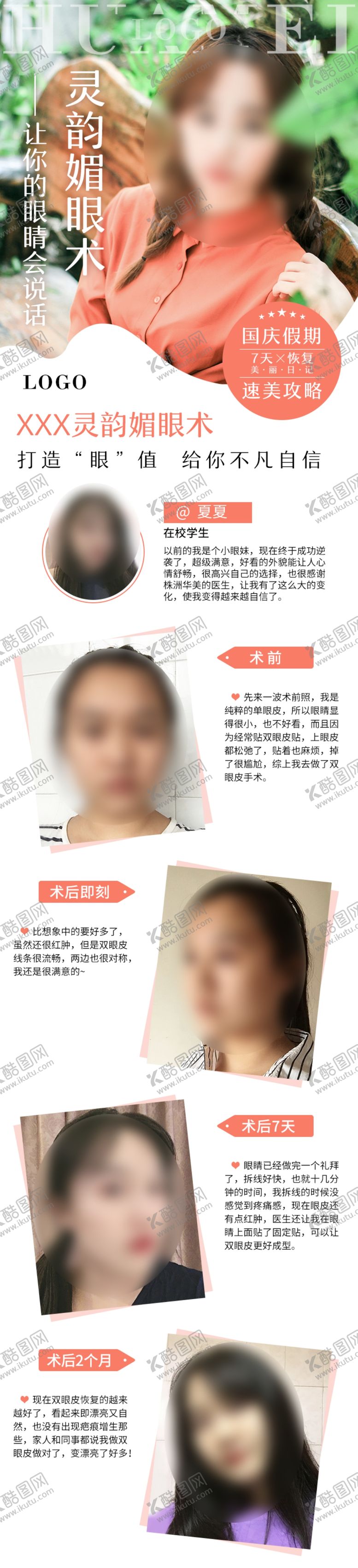 编号：53557910192204489602【酷图网】源文件下载-双眼皮术后日记