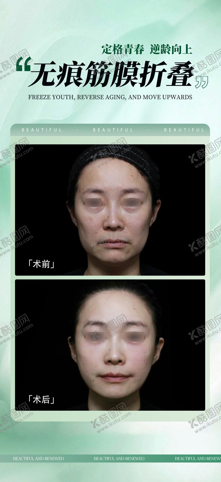 编号：62198610271035422787【酷图网】源文件下载-无痕筋膜提升海报