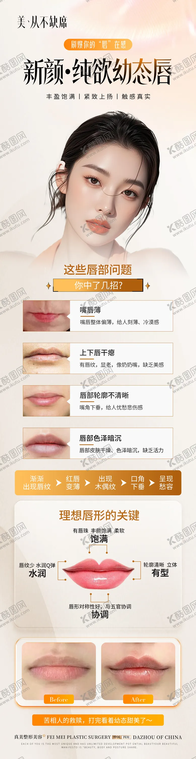 编号：75859004191721423985【酷图网】源文件下载-医美丰唇案例科普长图海报
