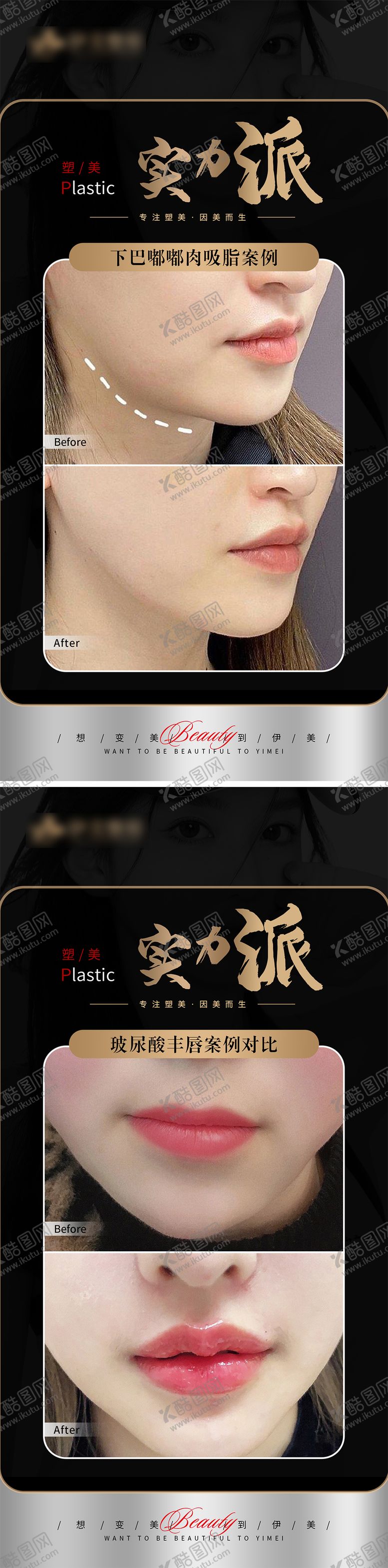 编号：54917810281123395628【酷图网】源文件下载-医美案例对比系列海报