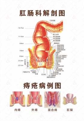 肛肠科PPH诊疗范围