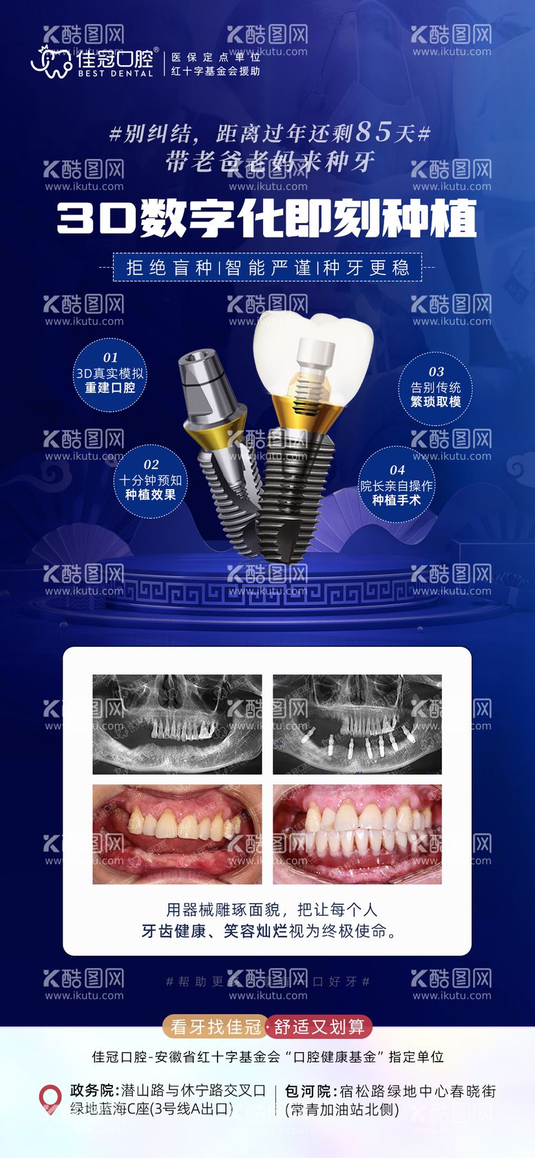 编号：14684012022117368496【酷图网】源文件下载-3D数字化即刻种植