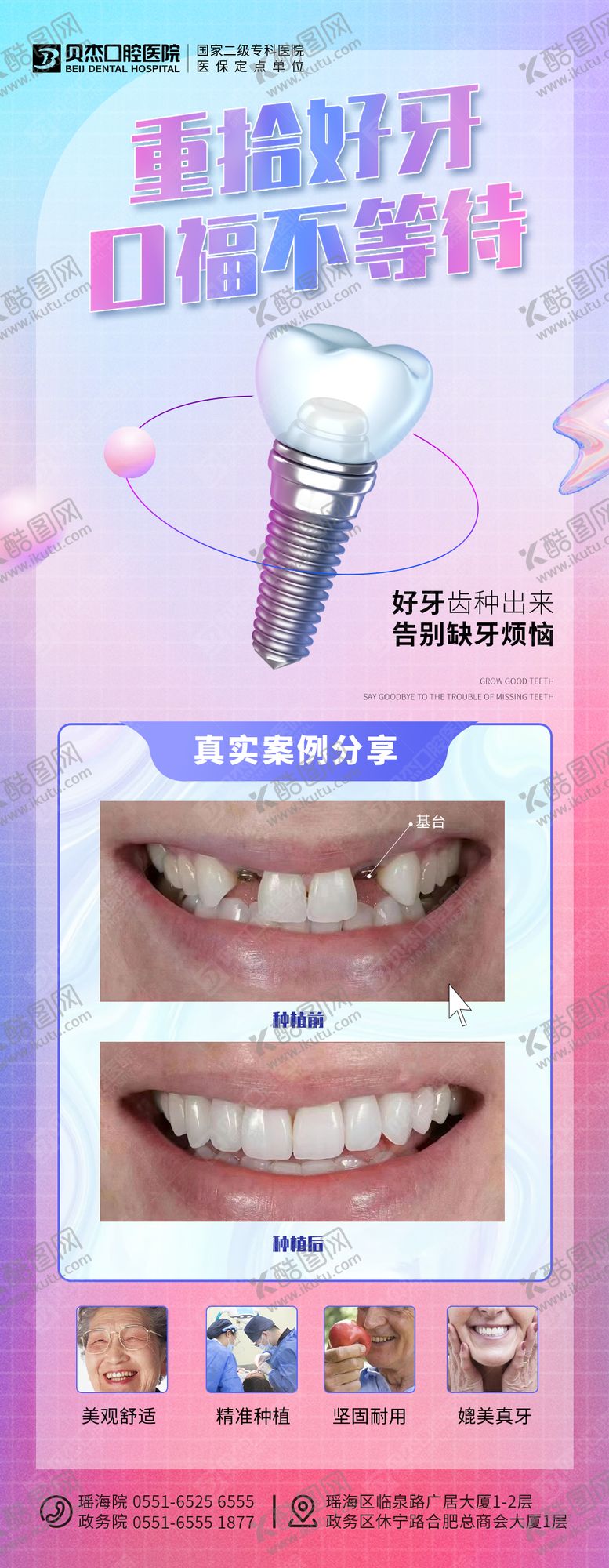 编号：51984912281757273014【酷图网】源文件下载-种植牙案例