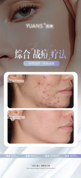 问题肌案例对比海报