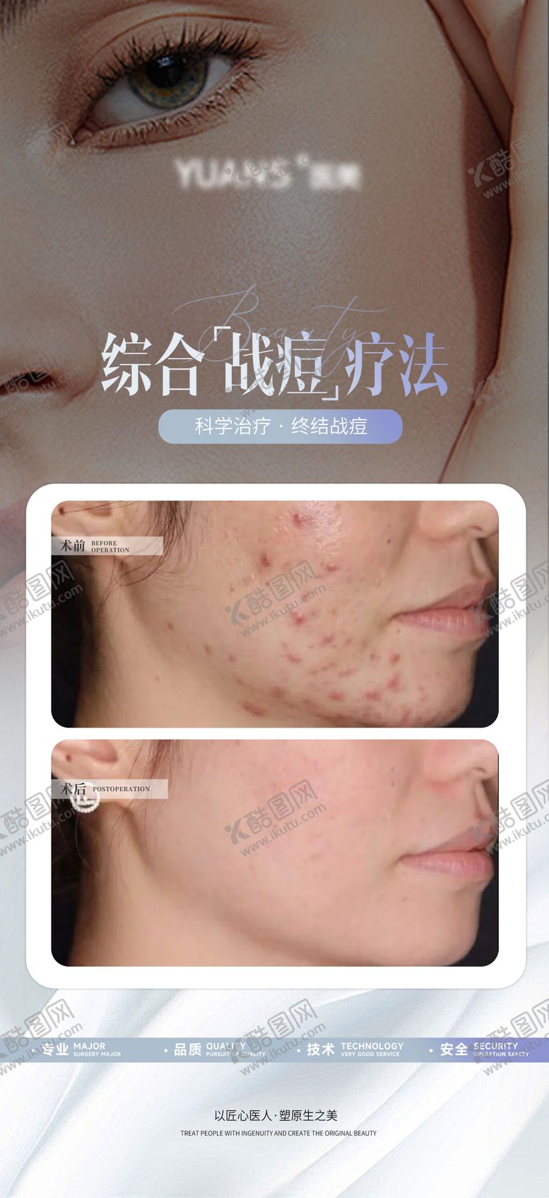 编号：52834608111608337013【酷图网】源文件下载-医美痘肌管理案例对比