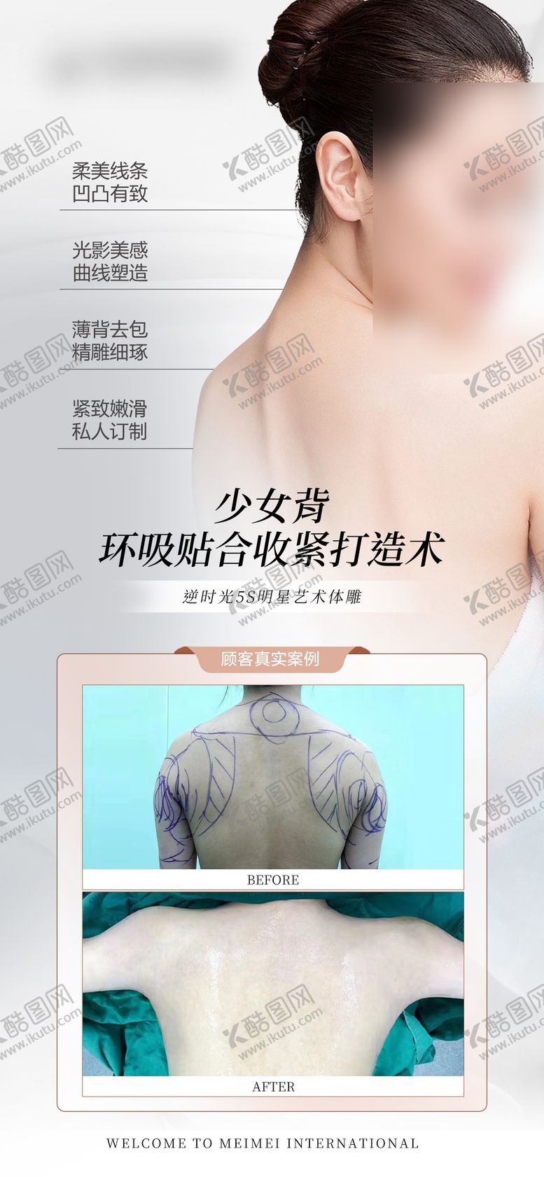 编号：51640701182148543732【酷图网】源文件下载-医美少女背整形案例