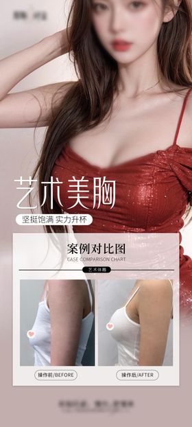 医美美胸活动长图