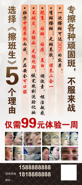 擦斑生美容祛斑展架易拉宝