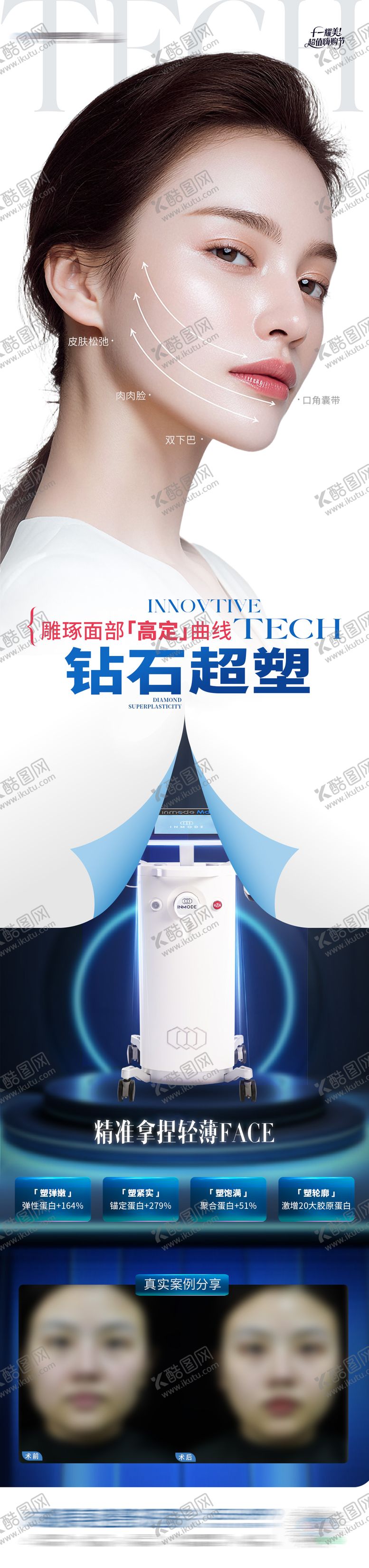 编号：84731010281726518593【酷图网】源文件下载-医美钻石超塑仪器全面部案例创意海报