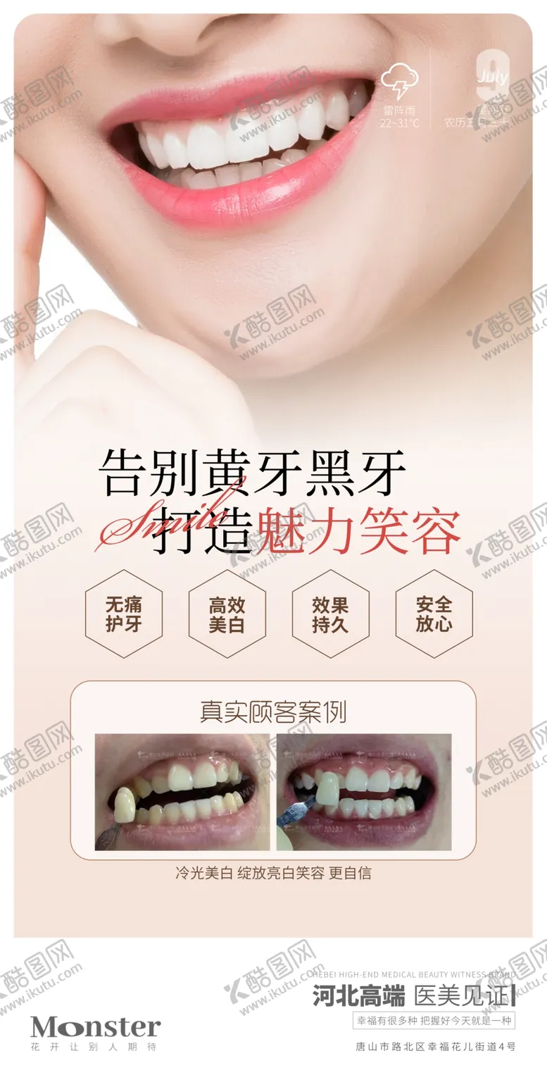 编号：38060711271821323490【酷图网】源文件下载-医美牙齿贴面