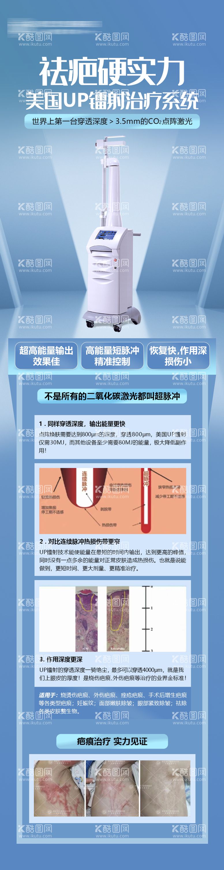 编号：43906511171537242965【酷图网】源文件下载-医美整形美容祛疤仪器海报长图