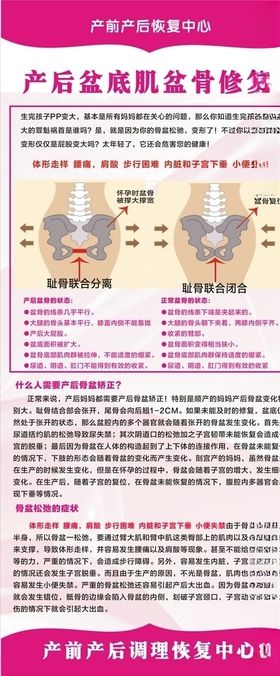 产后盆底股盆骨修复展架