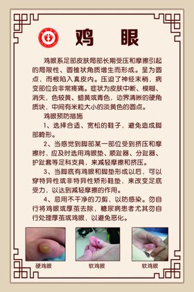 鸡眼