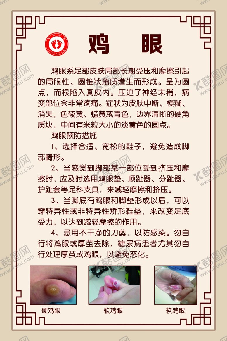 编号：73160305120348438244【酷图网】源文件下载-鸡眼