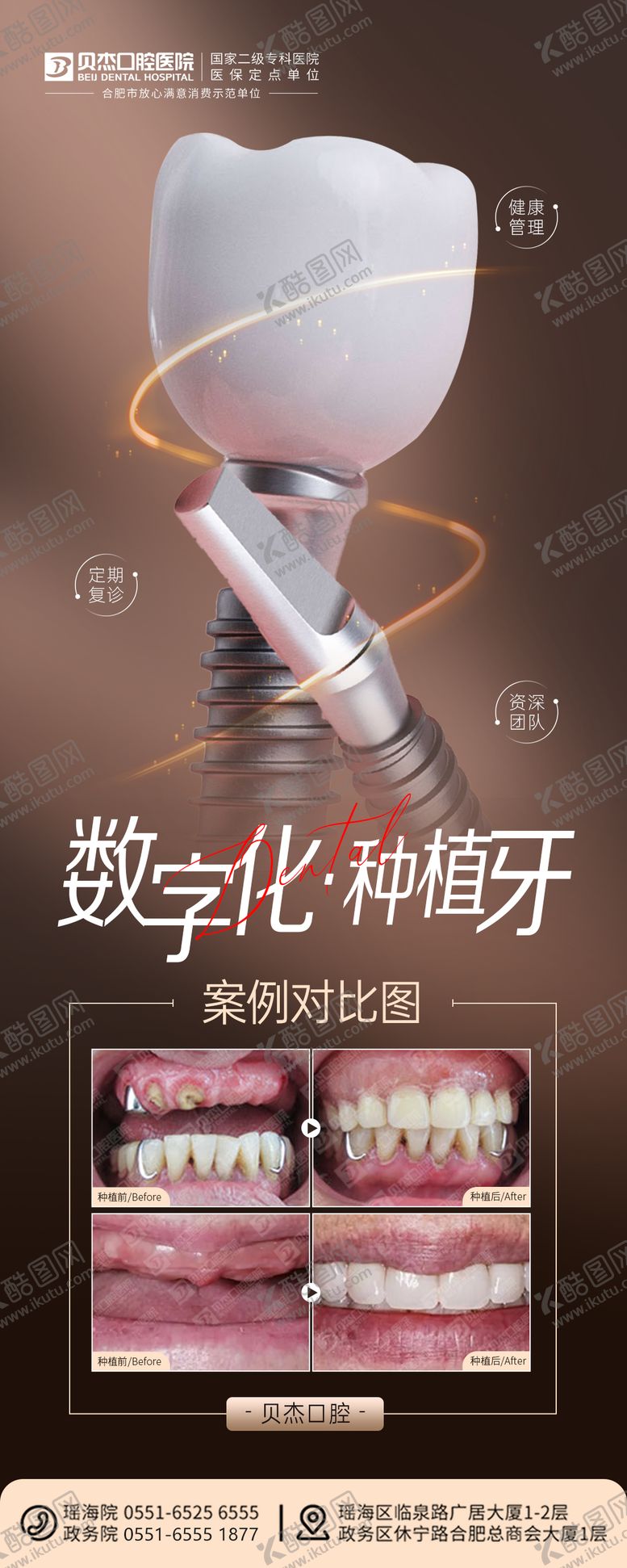 编号：72852811211545121244【酷图网】源文件下载-种植牙宣传海报