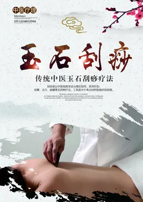 刮痧