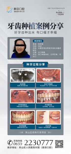 医美口腔种植牙案例对比海报