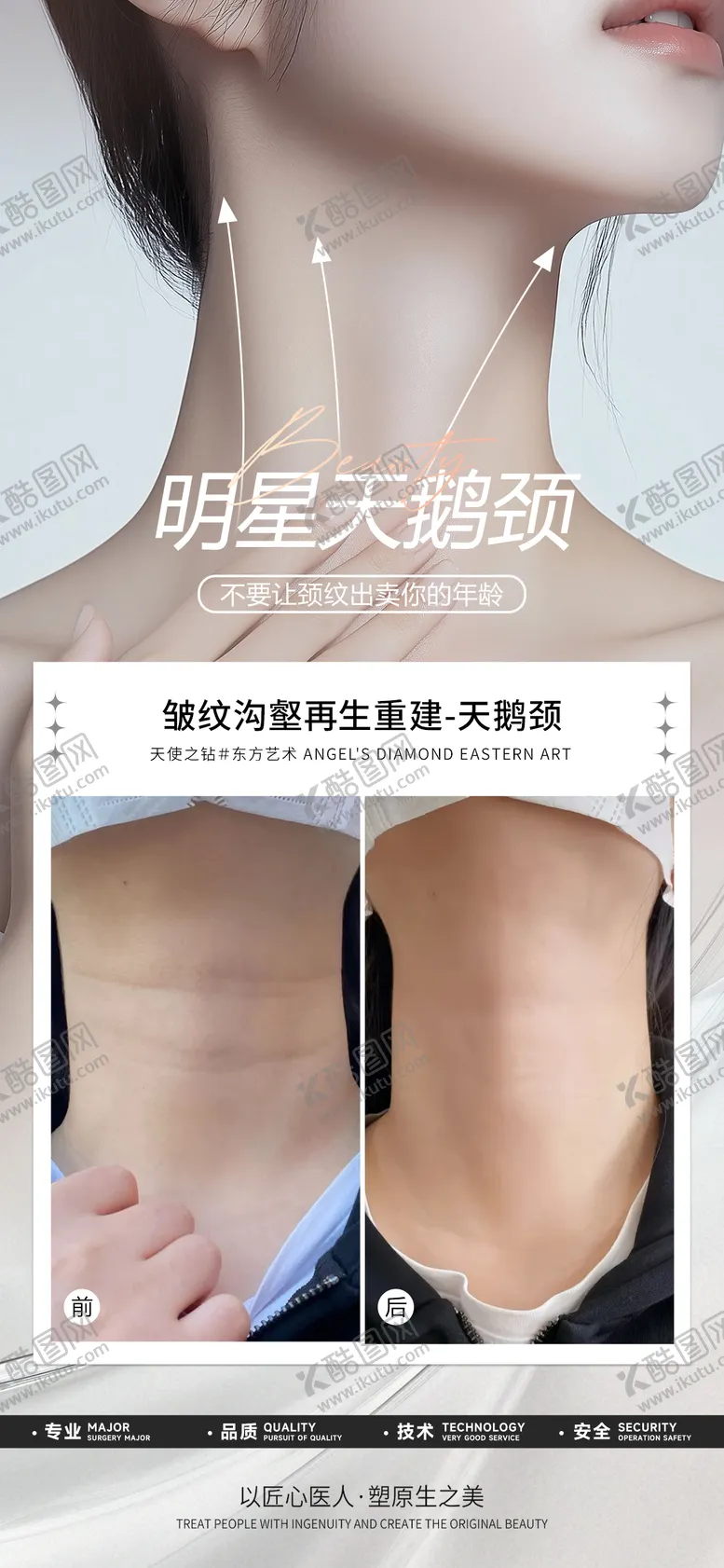 编号：46603605181400338464【酷图网】源文件下载-医美天鹅颈案例海报